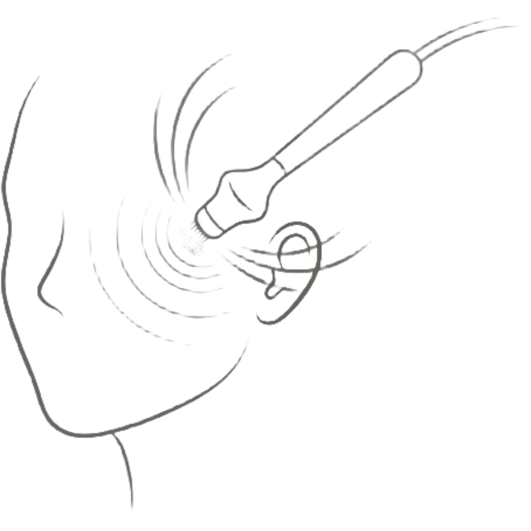 RF Microneedling RF Microneedling